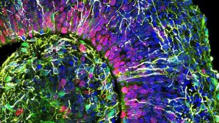 Скопления клеток в лаборатории спонтанно образуют мозговые волны
